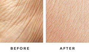 Before-And-After-Skin