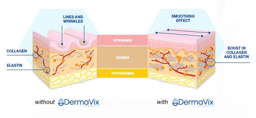 DermaVix For Acne Scars
